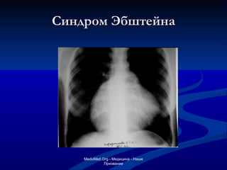 Синдром Эбштейна MeduMed.Org -  Медицина - Наше Призвание 