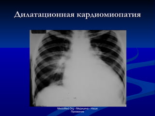 Дилатационная кардиомиопатия MeduMed.Org -  Медицина - Наше Призвание 
