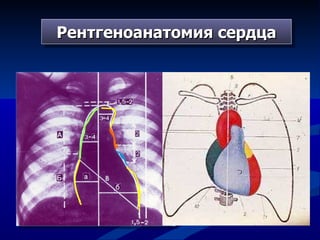 Рентгеноанатомия сердца 