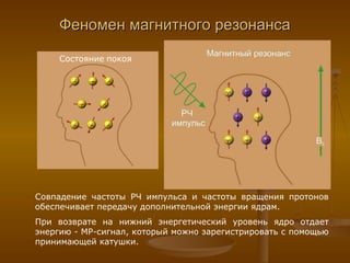Феномен магнитного резонанса Состояние   покоя Совпадение частоты РЧ импульса и частоты вращения протонов обеспечивает передачу дополнительной энергии ядрам. При возврате на нижний энергетический уровень ядро отдает энергию - МР-сигнал, который можно зарегистрировать с помощью принимающей катушки. 
