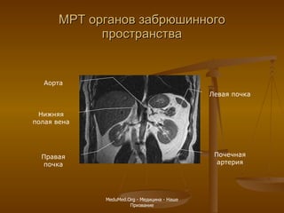 МРТ органов забрюшинного пространства Правая почка Левая почка Аорта Почечная артерия Нижняя полая вена MeduMed.Org -  Медицина - Наше Призвание 