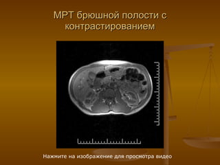 МРТ брюшной полости с контрастированием Нажмите на изображение для просмотра видео 