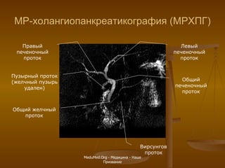 МР-холангиопанкреатикография (МРХПГ) Общий желчный проток Вирсунгов проток Пузырный проток (желчный пузырь удален) Общий печеночный проток Правый печеночный проток Левый печеночный проток MeduMed.Org -  Медицина - Наше Призвание 