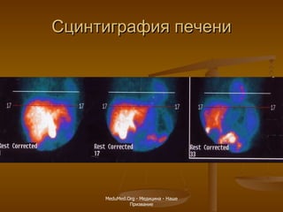Сцинтиграфия печени MeduMed.Org -  Медицина - Наше Призвание 