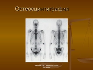 Остеосцинтиграфия MeduMed.Org -  Медицина - Наше Призвание 