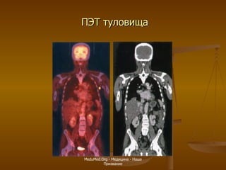 ПЭТ туловища MeduMed.Org -  Медицина - Наше Призвание 