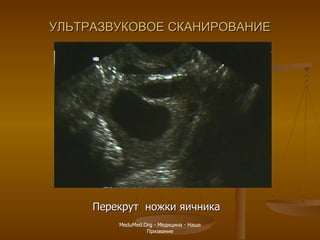 УЛЬТРАЗВУКОВОЕ СКАНИРОВАНИЕ Перекрут  ножки яичника MeduMed.Org -  Медицина - Наше Призвание 