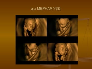 3-х МЕРНАЯ УЗД 