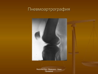 Пневмоартрография MeduMed.Org -  Медицина - Наше Призвание 