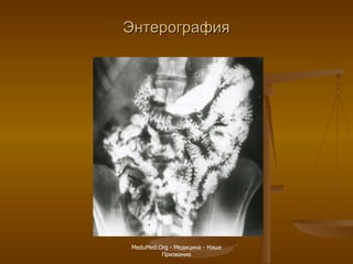 Энтерография MeduMed.Org -  Медицина - Наше Призвание 