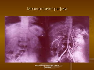 Мезентерикография MeduMed.Org -  Медицина - Наше Призвание 