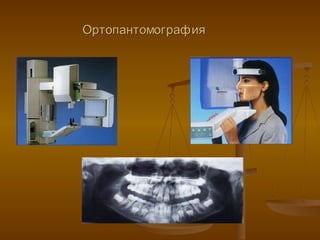 Ортопантомография 