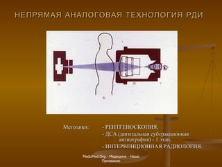 НЕПРЯМАЯ АНАЛОГОВАЯ ТЕХНОЛОГИЯ РДИ   Методики:  -  РЕНТГЕНОСКОПИЯ , - ДСА (дигитальная субтракционная      ангиография) - 1 этап, - ИНТЕРВЕНЦИОННАЯ РАДИОЛОГИЯ. MeduMed.Org -  Медицина - Наше Призвание 