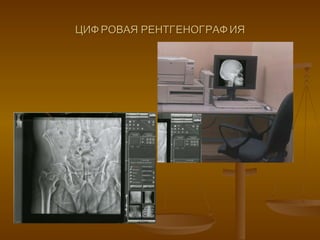 ЦИФРОВАЯ РЕНТГЕНОГРАФИЯ 