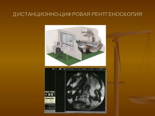 ДИСТАНЦИОННО-ЦИФРОВАЯ РЕНТГЕНОСКОПИЯ 