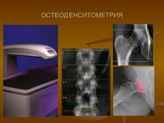 ОСТЕОДЕНСИТОМЕТРИЯ 