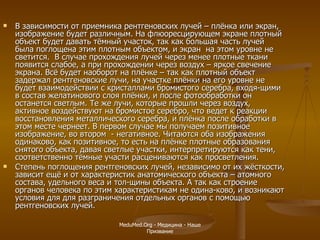 В зависимости от приемника рентгеновских лучей – плёнка или экран, изображение будет различным. На флюоресцирующем экране плотный объект будет давать тёмный участок, так как большая часть лучей была поглощена этим плотным объектом, и экран  на этом уровне не светится.  В случае прохождения лучей через менее плотные ткани появится слабое, а при прохождении через воздух – яркое свечение экрана. Всё будет наоборот на плёнке – так как плотный объект задержал рентгеновские лучи, на участке плёнки на его уровне не будет взаимодействии с кристаллами бромистого серебра, входя-щими в состав желатинового слоя плёнки, и после фотообработки он останется светлым. Те же лучи, которые прошли через воздух, активное воздействуют на бромистое серебро, что ведет к реакции восстановления металлического серебра, и плёнка после обработки в этом месте чернеет. В первом случае мы получаем позитивное изображение, во втором  - негативное. Читаются оба изображения одинаково, как позитивное, то есть на плёнке плотные образования снятого объекта, давая светлые участки, интерпретируются как тени, соответственно тёмные участи расцениваются как просветления. Степень поглощения рентгеновских лучей, независимо от их жёсткости, зависит ещё и от характеристик анатомического объекта – атомного состава, удельного веса и тол-щины объекта. А так как строение органов человека по этим характеристикам не одина-ково, и возникают условия для для разграничения отдельных органов с помощью рентгеновских лучей.  MeduMed.Org -  Медицина - Наше Призвание 