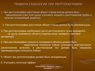 ПРАВИЛА СКИАЛОГИИ ПРИ РЕНТГЕНОГРАФИИ 1. При рентгенографии расстояние объект-плёнка всегда должно быть  максимальным (при этом нужно учитывать мощность рентгеновской трубки и  наличие отсеивающей решётки). 2. При рентгенографии расстояние объект-плёнка должно быть минимальным . 3. При рентгенографии необходимо центр рентгеновского пучка направлять  на центр снимаемого объекта (периодически проверять световой центратор!)  4. При рентгенографии плоскость снимаемого объекта должна быть  параллельна плоскости плёнки (учитывать анатомическое расположение органов!), а рентгеновский луч должен быть направлен перпендикулярно плоскости плёнки. 5. Объект при рентгенографии должен быть неподвижным. 6. Учитывать пяточный эффект.  MeduMed.Org -  Медицина - Наше Призвание 