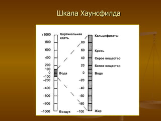 Шкала Хаунсфилда Кальцификаты Кровь Серое вещество Белое вещество Вода Жир Кортикальная  кость Вода Воздух 