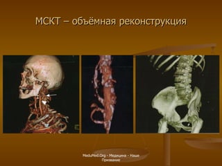 МСКТ – объёмная реконструкция MeduMed.Org -  Медицина - Наше Призвание 
