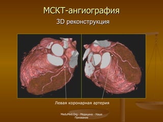 МСКТ-ангиография   3 D  реконструкция Левая коронарная артерия MeduMed.Org -  Медицина - Наше Призвание 