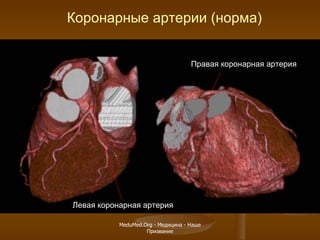 Коронарные артерии (норма) Правая коронарная артерия Левая коронарная артерия MeduMed.Org -  Медицина - Наше Призвание 