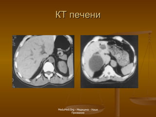 КТ печени MeduMed.Org -  Медицина - Наше Призвание 