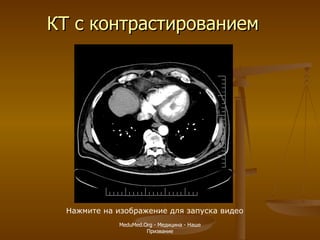 КТ с контрастированием Нажмите на изображение для запуска видео MeduMed.Org -  Медицина - Наше Призвание 