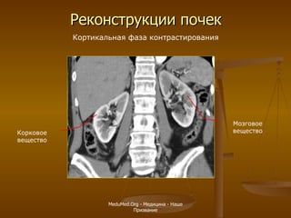 Реконструкции почек Кортикальная фаза контрастирования Корковое вещество Мозговое вещество MeduMed.Org -  Медицина - Наше Призвание 