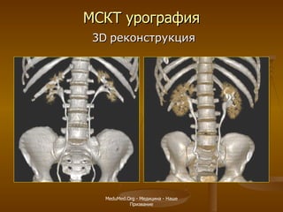 МСКТ урография   3 D   реконструкция MeduMed.Org -  Медицина - Наше Призвание 