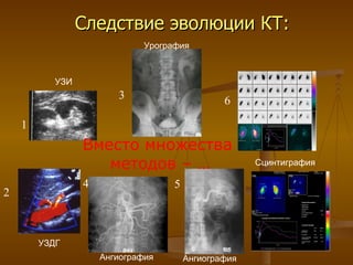 Следствие эволюции КТ: 1 6 3 5 2 4 УЗИ Урография УЗДГ Ангиография Ангиография Сцинтиграфия Вместо множества  методов – … 