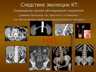 Следствие эволюции КТ: Сокращение сроков обследования пациентов   (замена принципа «от простого к сложному»  на «выполнение наиболее информативного метода») МСКТ 