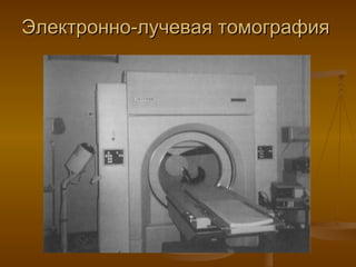 Электронно-лучевая томография 
