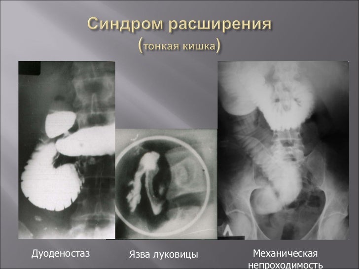 Дочке 6 лет болит низ живота