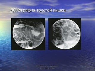 ДОКография толстой кишки MeduMed.Org -  Медицина - Наше Призвание 