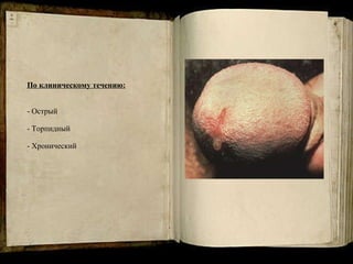 По клиническому течению: - Острый  - Торпидный - Хронический 
