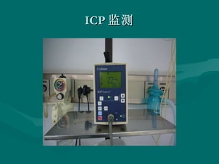 ICP 监测 