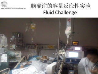 脑灌注的容量反应性实验 Fluid Challenge  CHINA International Neuroscience Institute ICU 