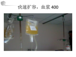 快速扩容，血浆 400 