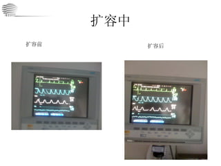 扩容中 扩容前 扩容后 