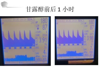 甘露醇前后 1 小时 