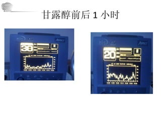 甘露醇前后 1 小时 