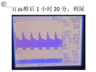 甘露醇后 1 小时 20 分，利尿 