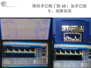 维持多巴酚丁胺 10 ；加多巴胺 5 ，逐渐加量 