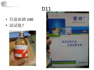 D11  目前血钠 140 试试他？ 