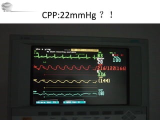 CPP:22mmHg ？！ 