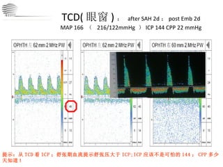 TCD( 眼窗 ) ：  after SAH 2d ； post Emb 2d MAP 166  （  216/122mmHg  ） ICP 144 CPP 22 mmHg 提示：从 TCD 看 ICP ；舒张期血流提示舒张压大于 ICP;ICP 应该不是可怕的 144 ； CPP 多少天知道 ! CHINA International Neuroscience Institute ICU 