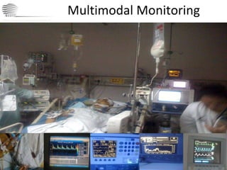 Multimodal Monitoring CHINA International Neuroscience Institute ICU 