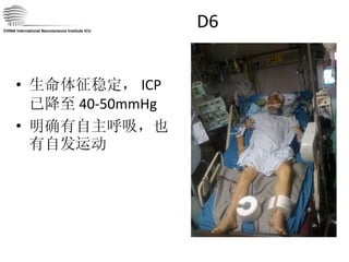 D6 生命体征稳定， ICP 已降至 40-50mmHg 明确有自主呼吸，也有自发运动 CHINA International Neuroscience Institute ICU 