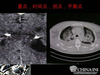 　  重点，时间点，拐点，平衡点 